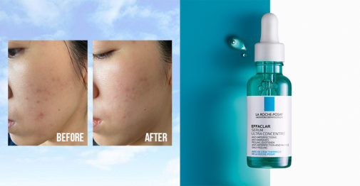 La Roche-Posay Effaclar Serum: Pori Halus, Anti-Penuaan